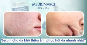 Serum cho da khô thiếu ẩm, phục hồi da nhanh nhất? | Medicnarci Korea