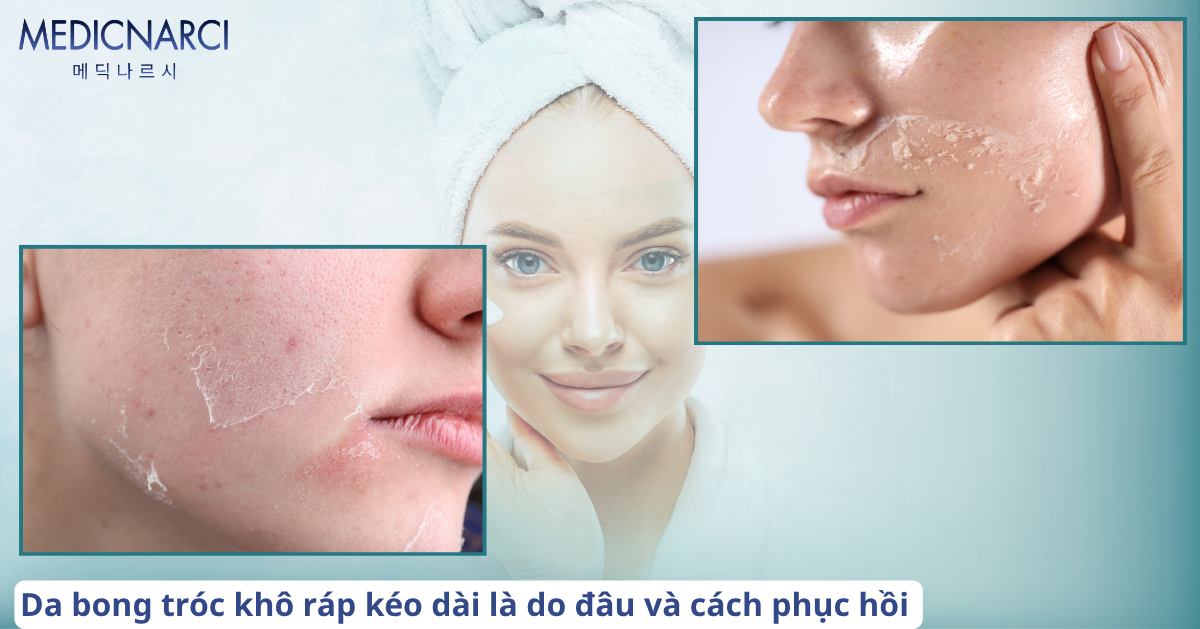 Da bong tróc khô ráp kéo dài là do đâu và cách phục hồi | Medicnarci Korea